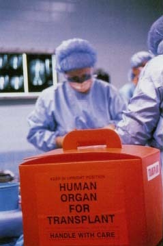 Organ for transplant. If kidney disease leads to kidney failure, dialysis or kidney transplant may be necessary. © 1996 Michelle Del SuerciolCustom Medical Stock Photo.